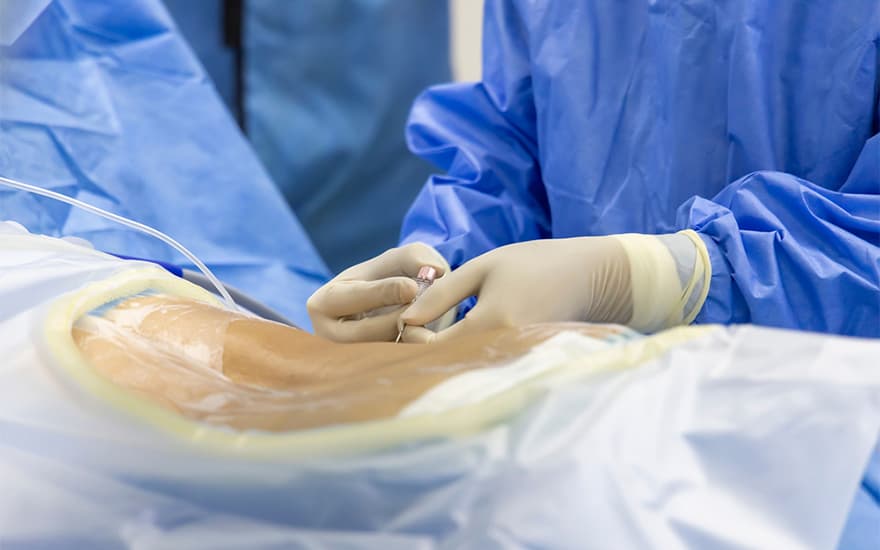Laser Endoscopic Discectomy