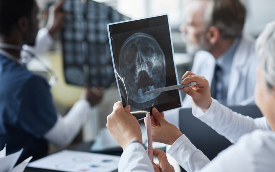 Traumatic Brain Injury (TBI)