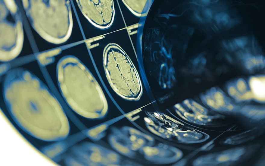 Revitalize Your Journey: Empowerment in Concussion Recovery