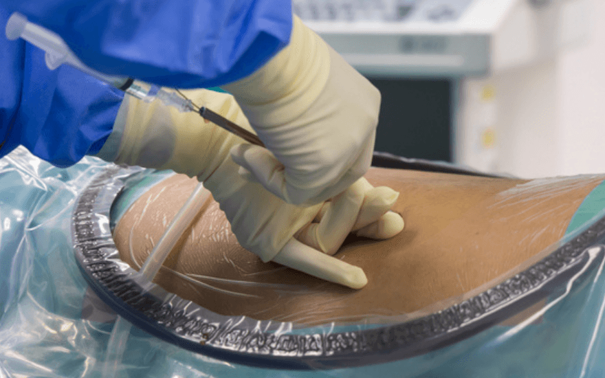 Managing Pain: LESIs Explained