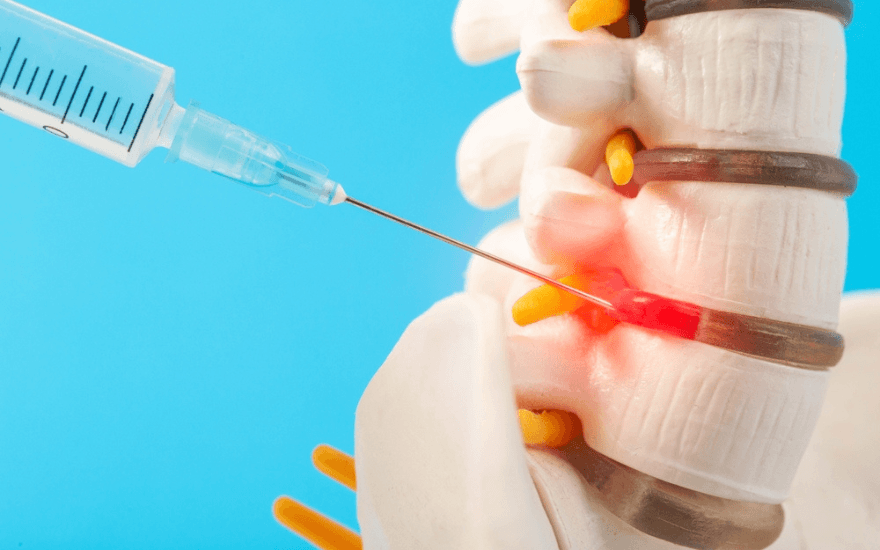 Precision Pain Relief: The Science and Future of Nerve Blocks