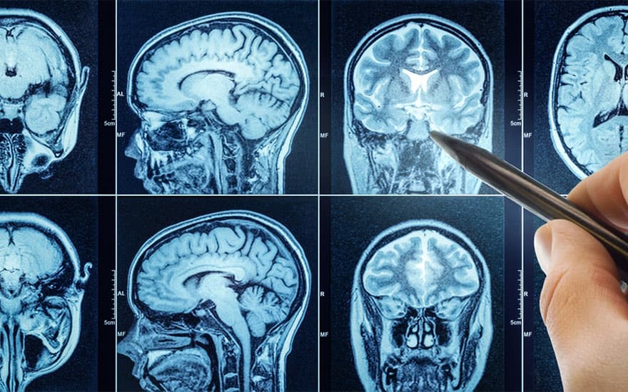 What You Didn’t Know About Your Brain That Will Surprise You