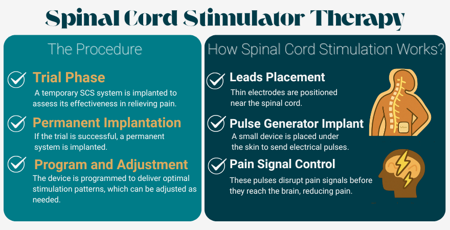 Spinal Cord Stimulator Therapy