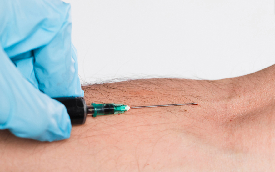 Peripheral Nerve Blocks