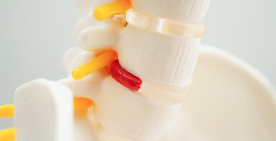Approaches to Sciatica and Coccyx Pain Therapy