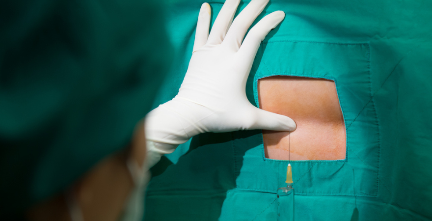 Everything You Need to Know About Epidural