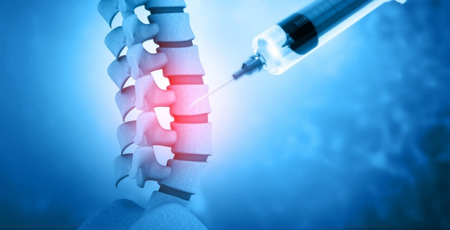 Managing Pain: LESIs Explained