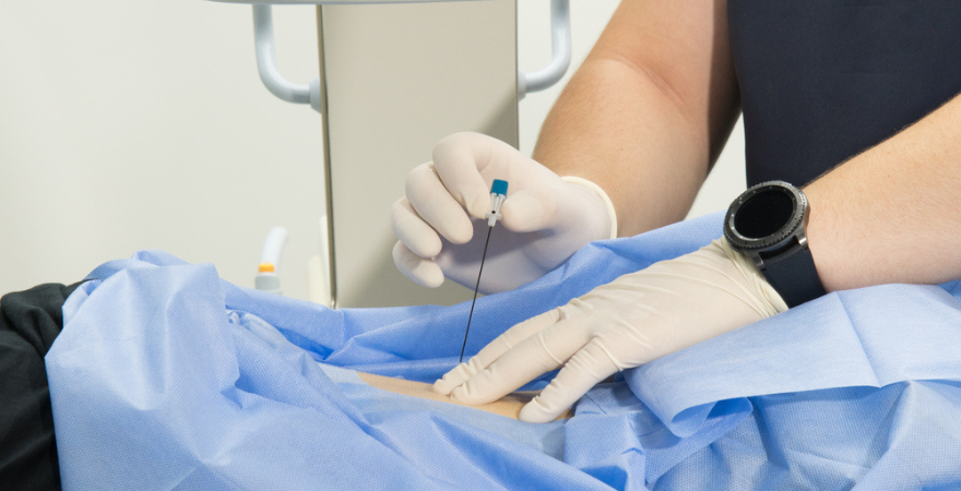 Precision Pain Relief: The Science and Future of Nerve Blocks