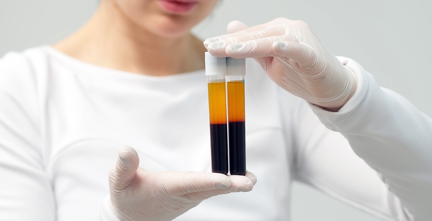 Is PRP Therapy Right for You? See It's Pain Relief Potential